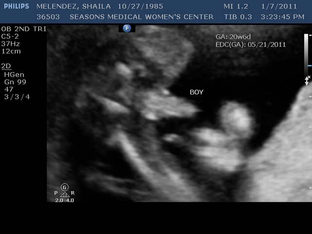 I FOUND OUT THE GENDER OF MY SON