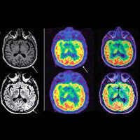 Durante la década de 1990