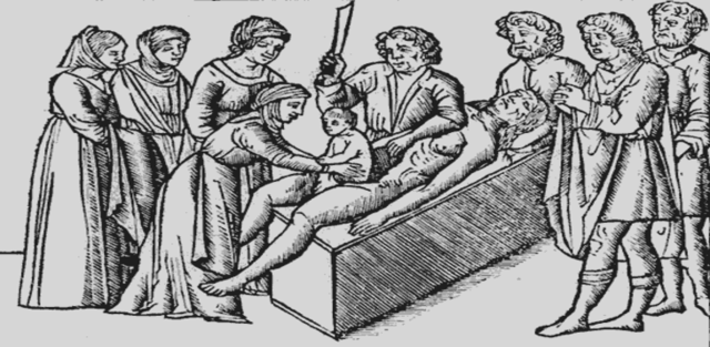 Medicina Prehipocrática