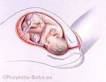 PRODÓMICO O PREPARTO