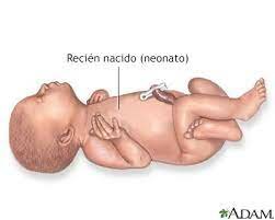 NEONATO