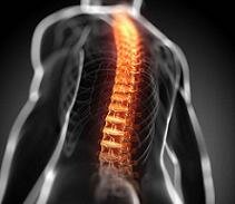 El raquioma es descrito por JUNGHANS