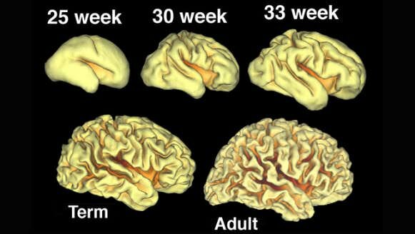 Los hemisferios cerebrales crecen y se inicia la formación de los surcos y las circunvoluciones.