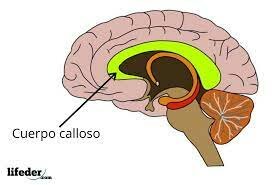 Cuerpo calloso