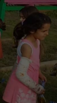 Em vaig trencar el braç