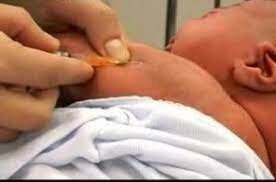 Descubrimiento de vacuna contra Tuberculosis