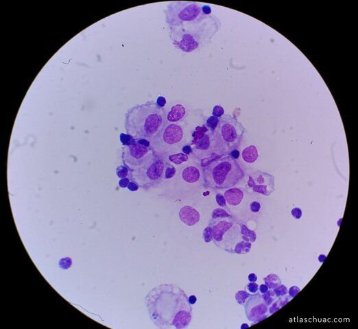 Desarrollo del microscopio