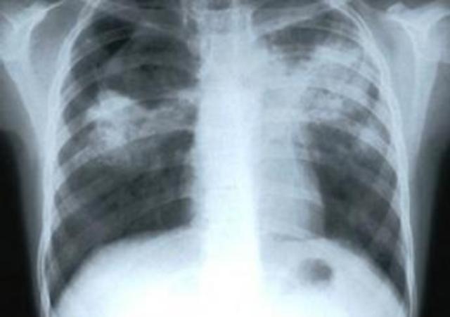 Poe's sister is born