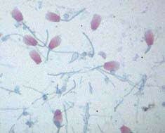 Anton Van Leeuwenhoek