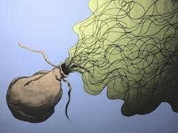 Bag of Wind -Summary