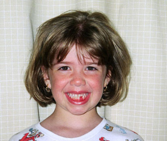 Bruna perdeu seu primeiro dente