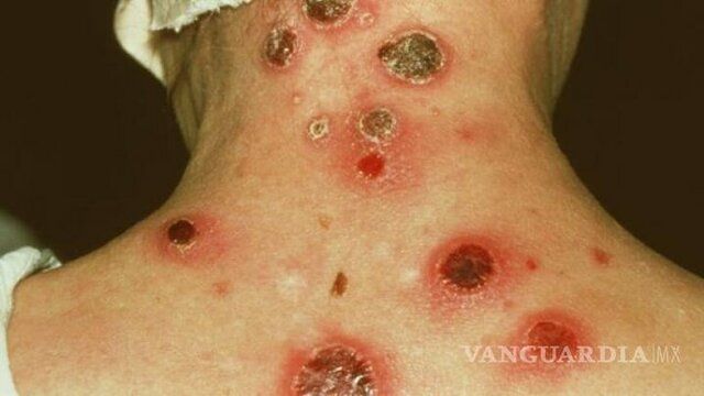 Rasgos Más Generales Del Humanismo Exótico