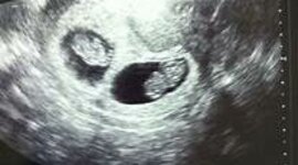 Timeline: COMO HIJA