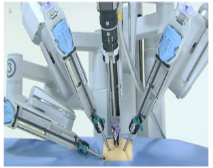 Cirugía Robótica con láser no invasiva