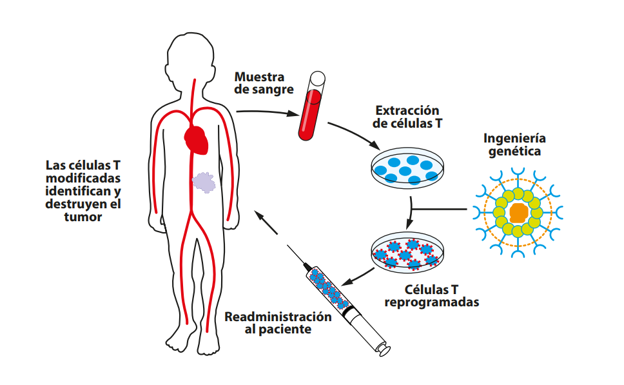 Uso de la terapia genética contra la leucemia
