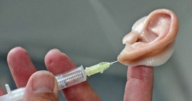 Se usan polimeros en los biomateriales