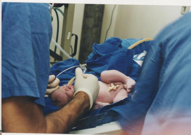 Nascimento do Cabelo