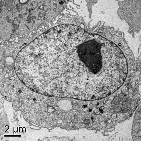 Se descubrieron para misfold los fragmentos transformados de la proteína del huntington (mHTT)