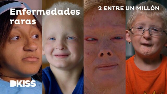 Enfermedades genéticas raras