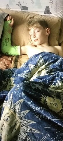 Bras dans le plâtre