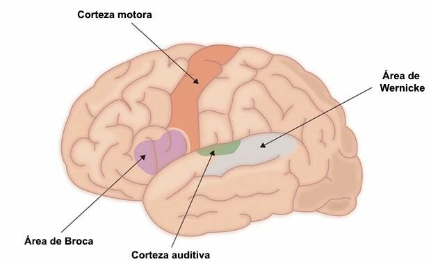 Paul Broca