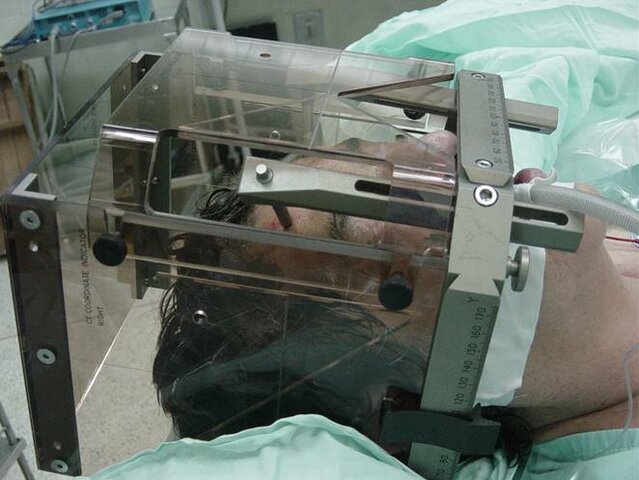 D.N. Zernov, el anatomista de Moscú