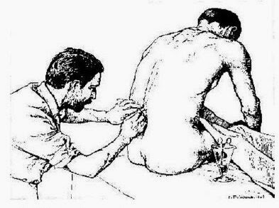 Se crea la anestesia raquídea.