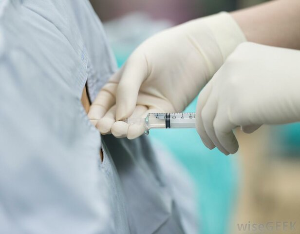 Se crea la anestesia peridural.