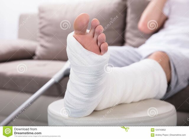 Se utiliza el yeso común y corriente.