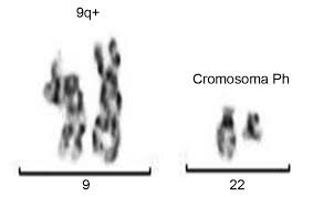 Nowell y Hungerford descrubren cromosoma Filadelfia