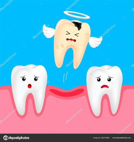 Breaking my two front teeth