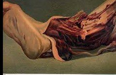 William being shot in the leg