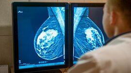 Timeline: TRATAMIENTOS Y MEDICACION CÁNCER DE MAMA
