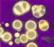 Primeras formas de vida: coacervados / Bacterias / Fotosíintesis y clorofila