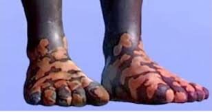 Possivel Cumprimento da Profecia