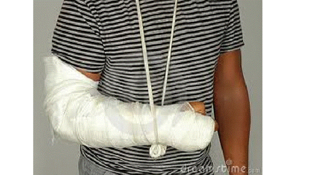 Quebrei o braço. (Leonardo Campos)