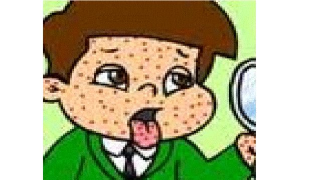 peguei catapora (Matheus)