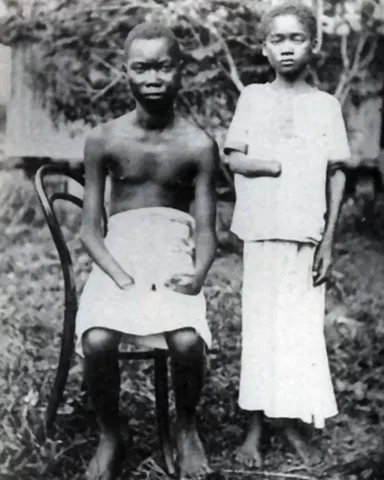 Worst of the Colonies