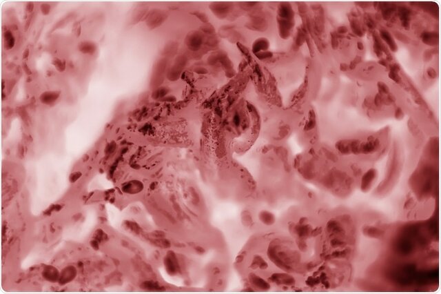 Descubrimiento de células HeLa