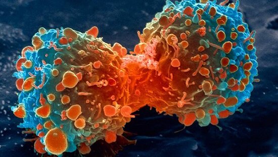 La primera cura de cáncer metastásico