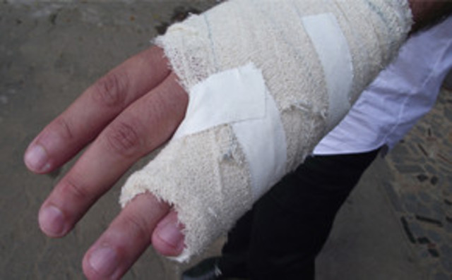 Quebrei meus dedos pela primeira vez (Matheus)