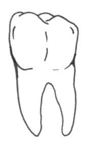 Meu dente caiu(felipe)