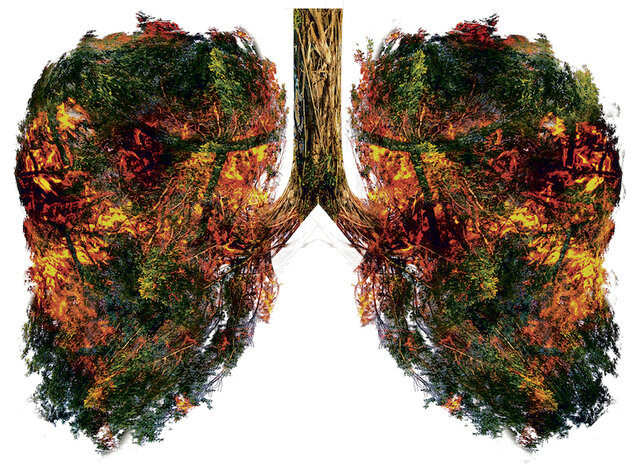 Medidas que podemos tomar