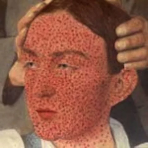 Small Pox Infect Natives