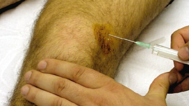 La despedida de OtaKu