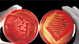 Timeline: HISTORIA DE LOS CULTIVOS DE CÉLULAS ANIMALES.