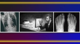 Timeline: Historia y Evolución de los estudios de Imagen