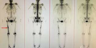 1951 Construcción del Scanner