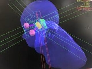 2007 escáner del todo el cuerpo fueron cambiando