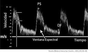 1842 Christian Johan Doppler